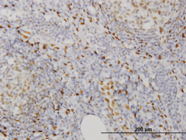 EBF3 Antibody in Immunohistochemistry (Paraffin) (IHC (P))