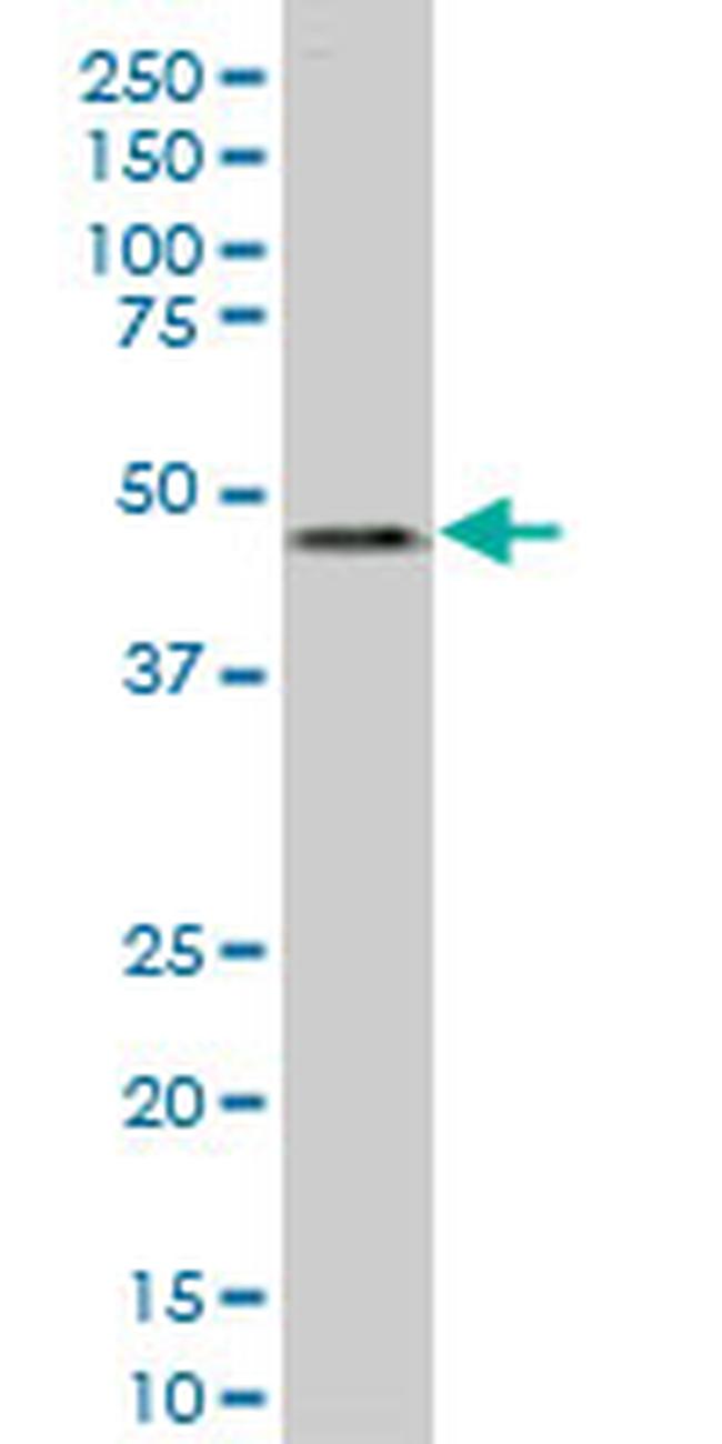 LASS6 Antibody in Western Blot (WB)