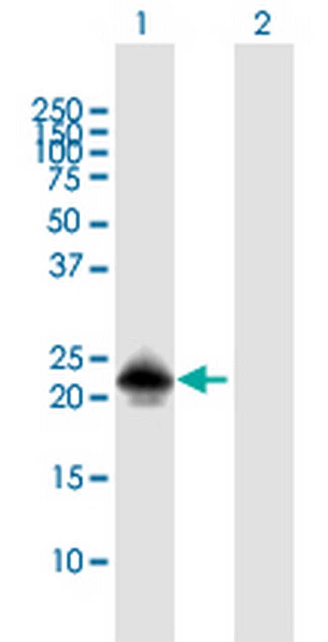 MSRB3 Antibody in Western Blot (WB)