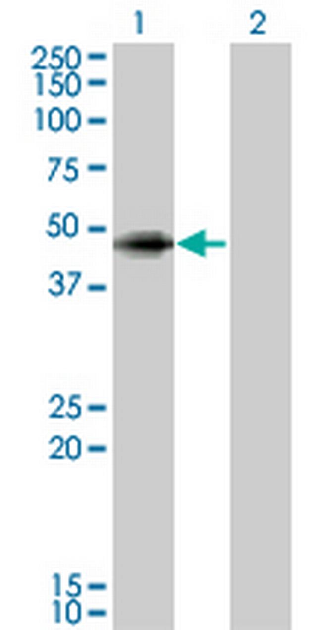 ANGPTL5 Antibody in Western Blot (WB)