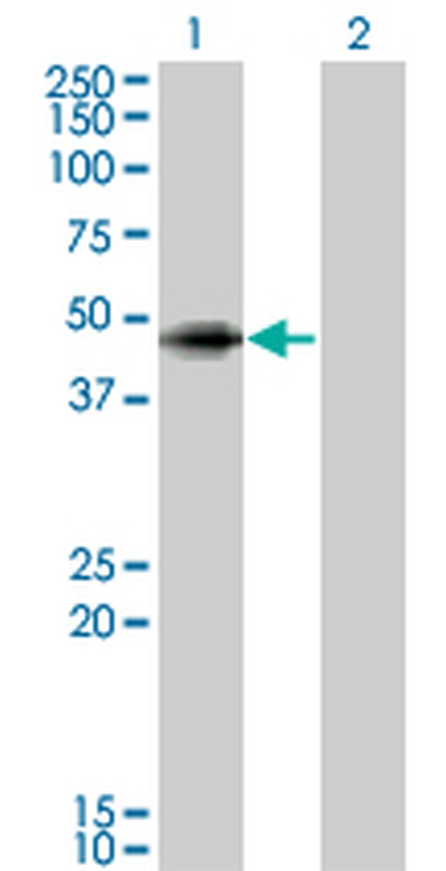 ANGPTL5 Antibody in Western Blot (WB)
