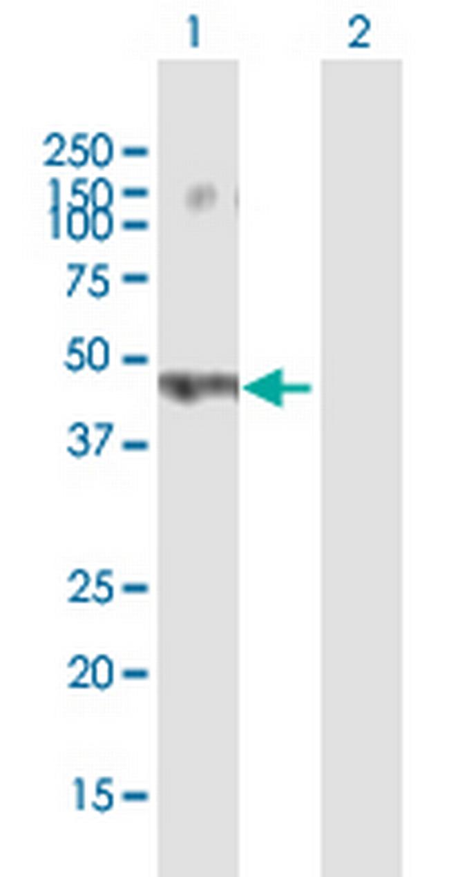 FLJ30934 Antibody in Western Blot (WB)