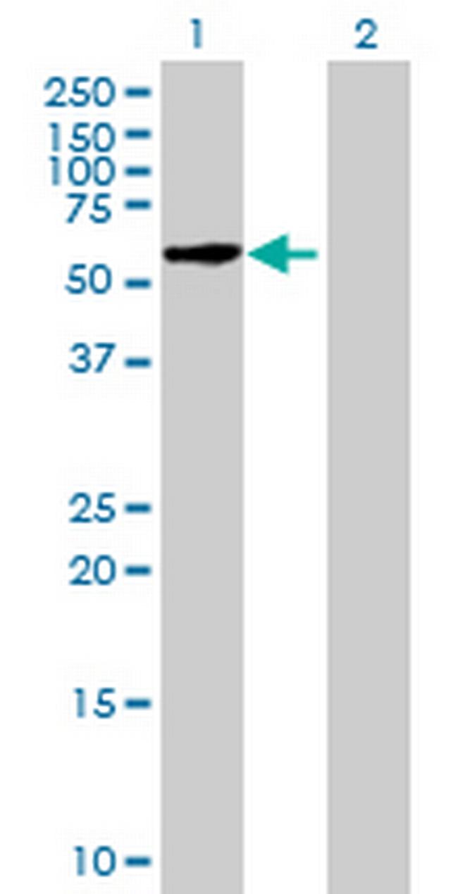 FBXO33 Antibody in Western Blot (WB)