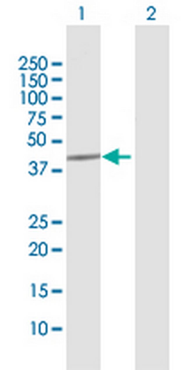 MCM9 Antibody in Western Blot (WB)