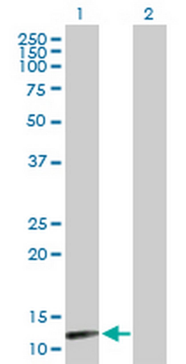 NUDT8 Antibody in Western Blot (WB)