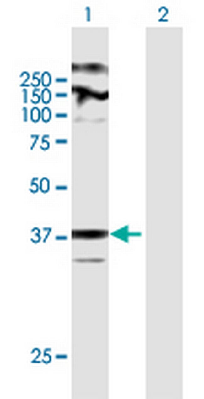 ZDHHC23 Antibody in Western Blot (WB)