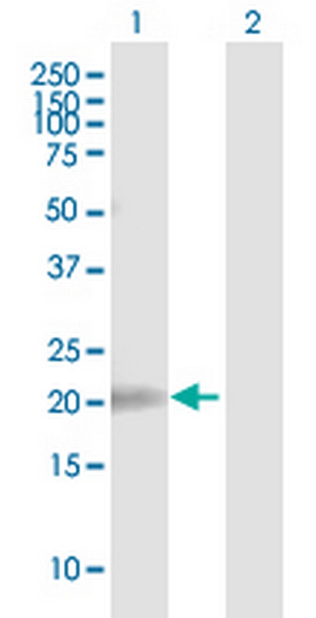 MPV17L Antibody in Western Blot (WB)