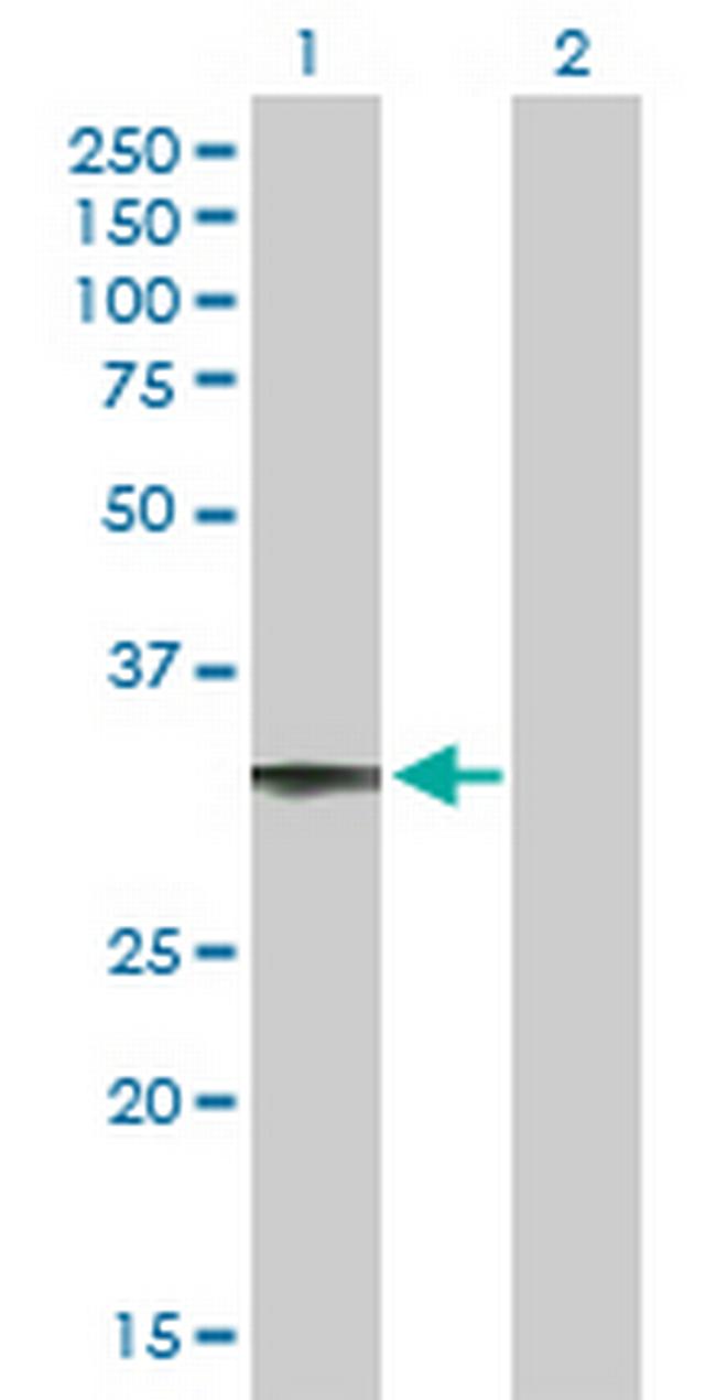 CCDC108 Antibody in Western Blot (WB)