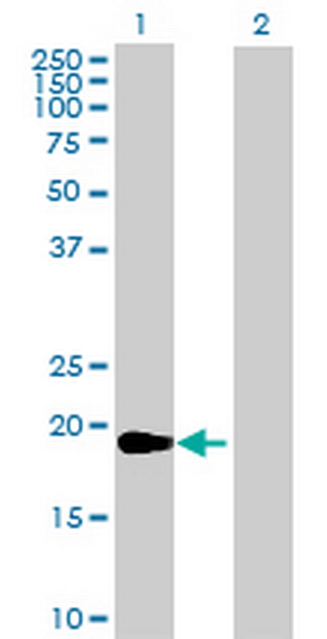 CCDC108 Antibody in Western Blot (WB)