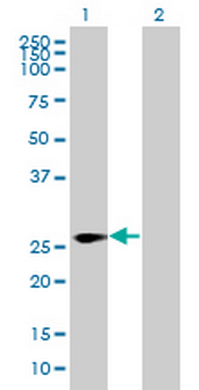 LRRC57 Antibody in Western Blot (WB)