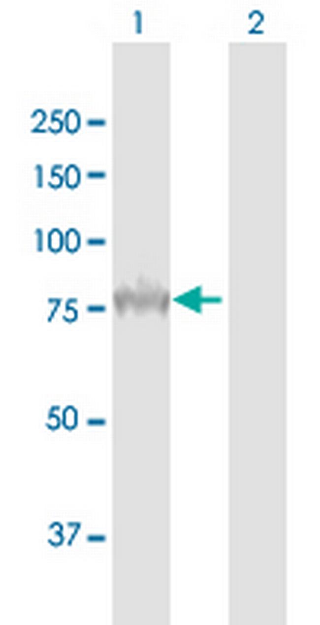 PCSK9 Antibody in Western Blot (WB)