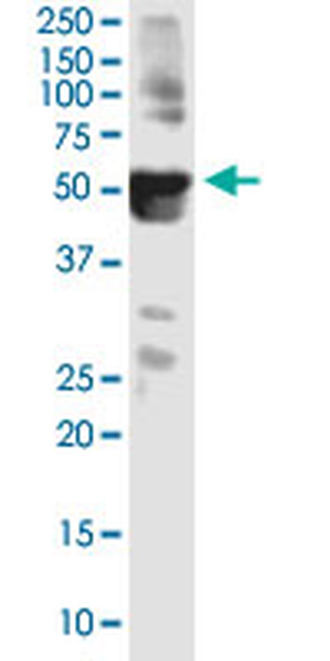 ANKS4B Antibody in Western Blot (WB)