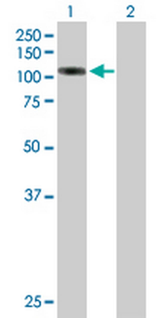 ALS2CL Antibody in Western Blot (WB)