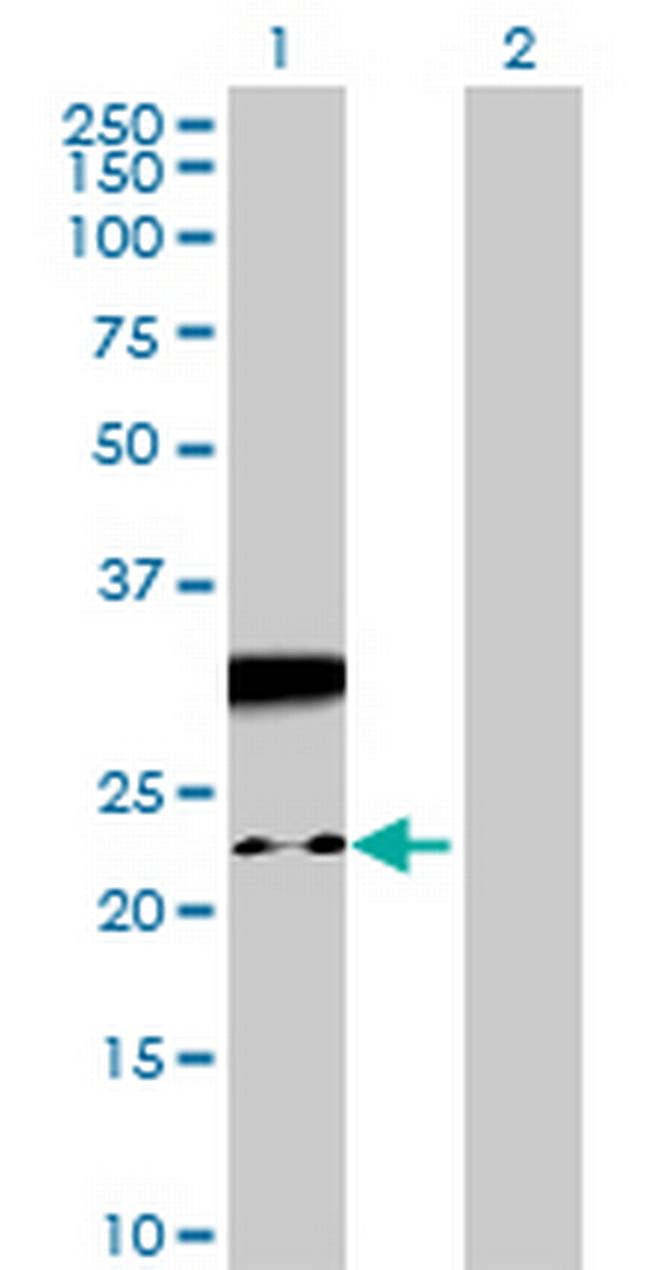 NAP1L5 Antibody in Western Blot (WB)