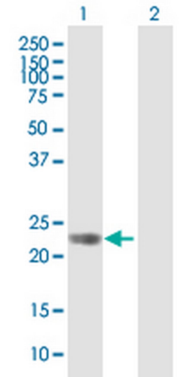 GPR110 Antibody in Western Blot (WB)