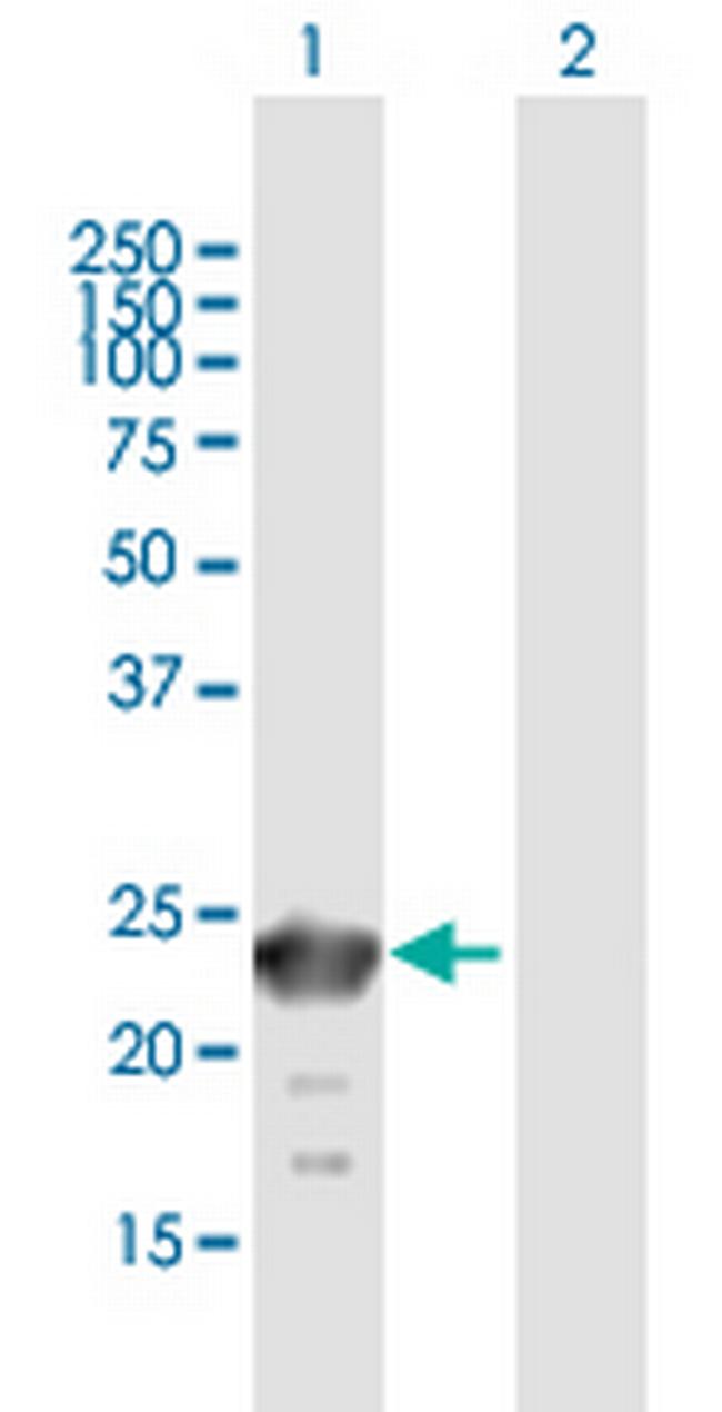 SSX6 Antibody in Western Blot (WB)