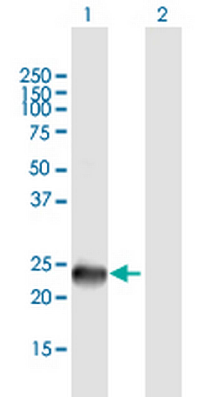 SSX9 Antibody in Western Blot (WB)