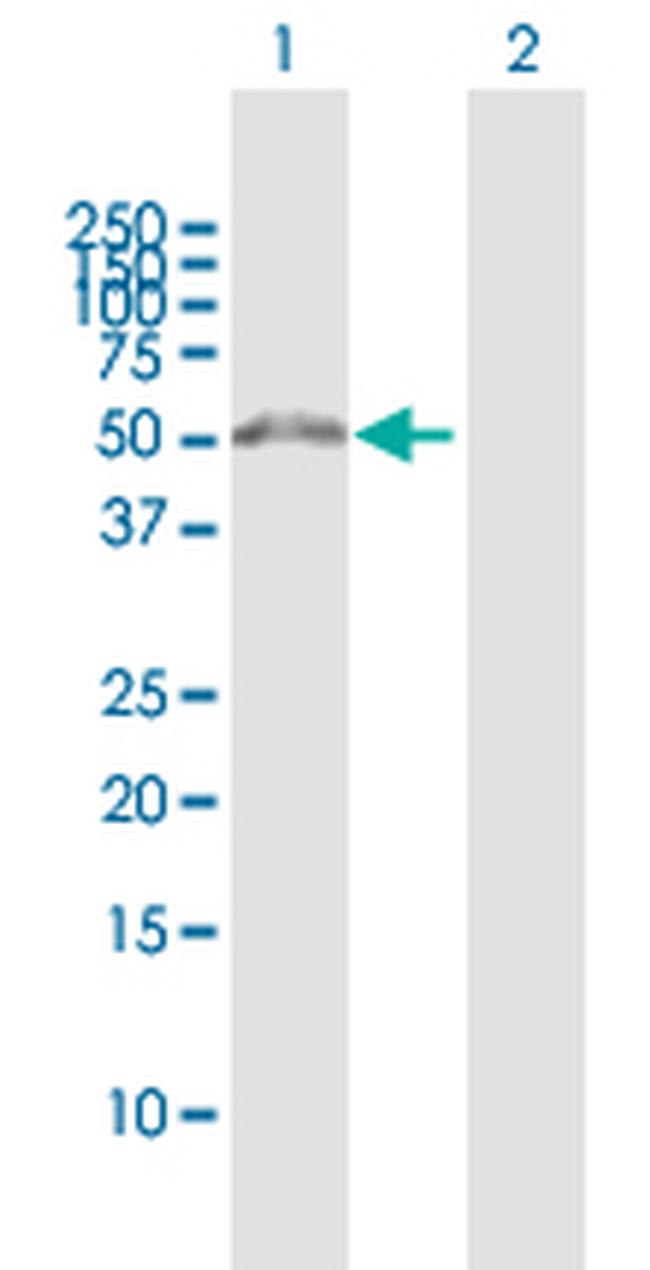 WDR51B Antibody in Western Blot (WB)