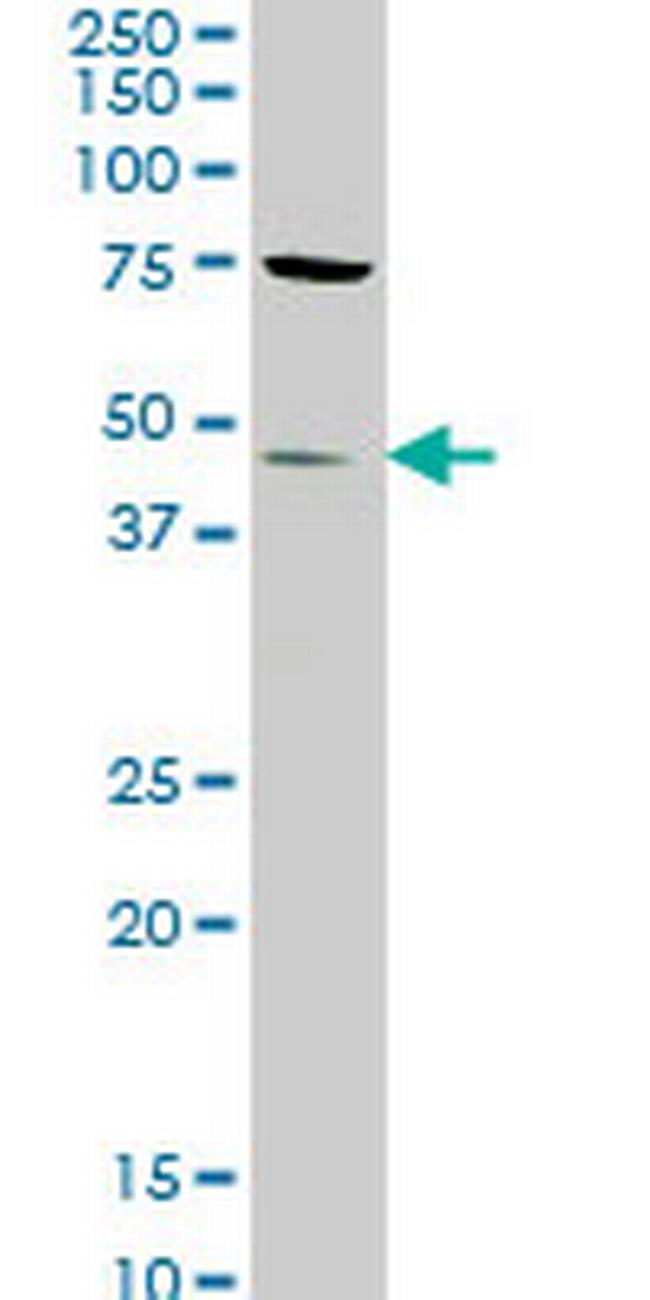 STK32C Antibody in Western Blot (WB)