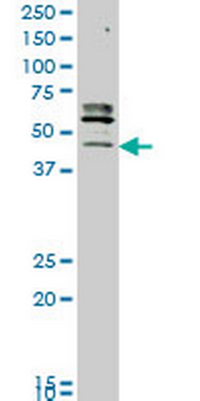 STK32C Antibody in Western Blot (WB)
