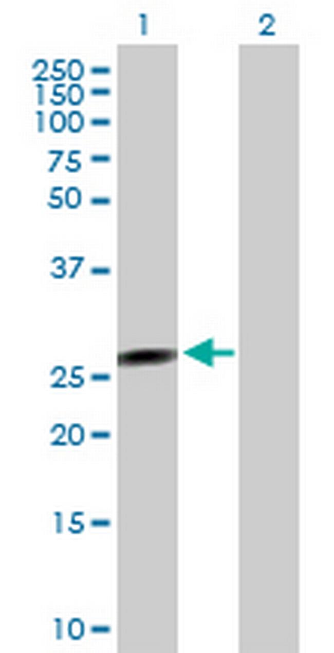 FLJ37201 Antibody in Western Blot (WB)