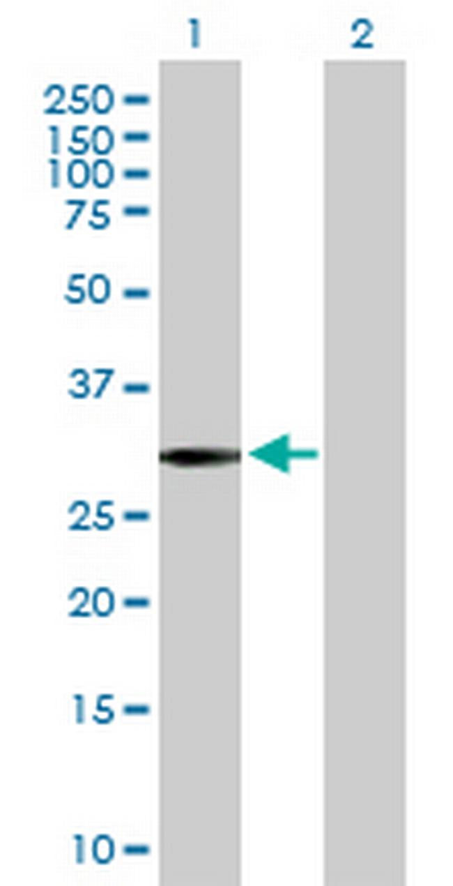 SLC22A24 Antibody in Western Blot (WB)