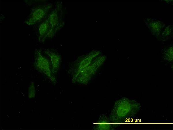 KSR2 Antibody in Immunocytochemistry (ICC/IF)