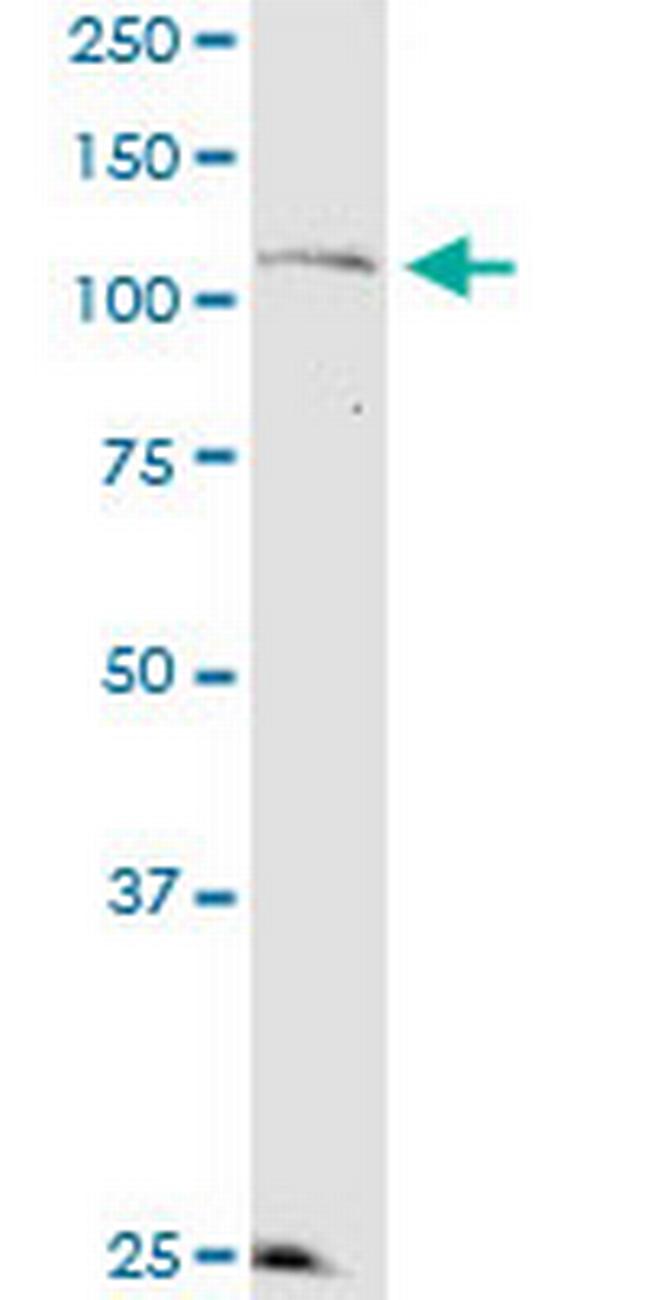 KSR2 Antibody in Western Blot (WB)