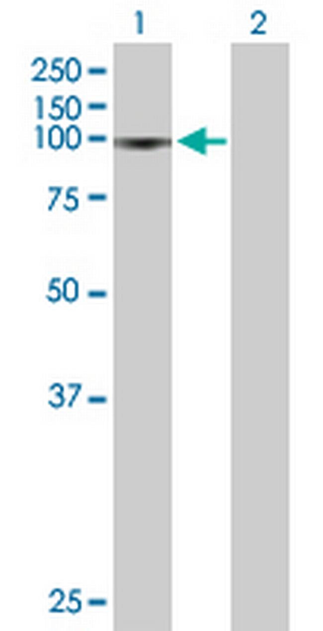 C13orf8 Antibody in Western Blot (WB)