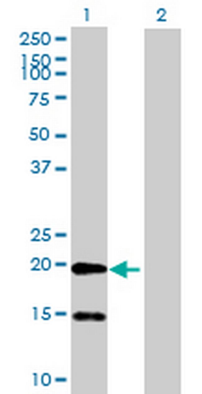 FLJ39743 Antibody in Western Blot (WB)