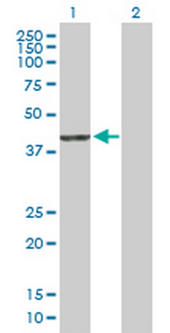 PDXDC2 Antibody in Western Blot (WB)