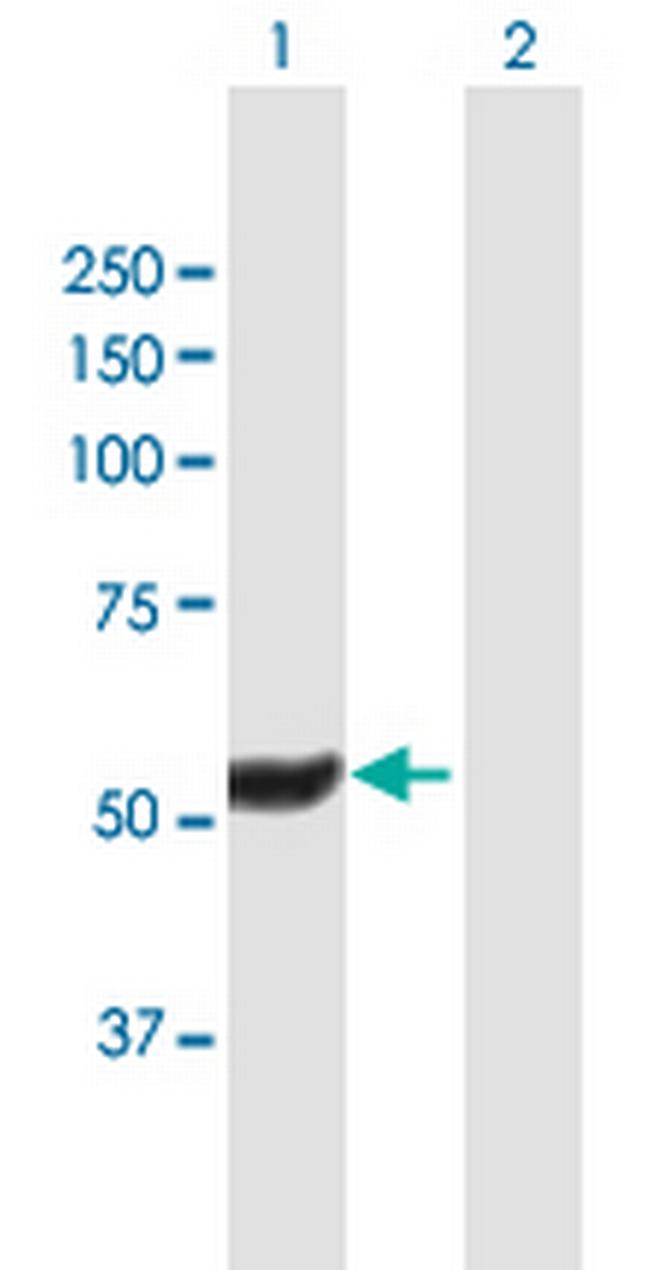 HEXDC Antibody in Western Blot (WB)