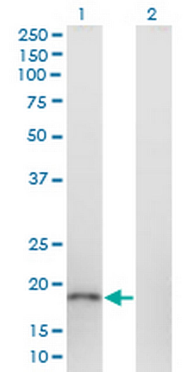 FAM44C Antibody in Western Blot (WB)