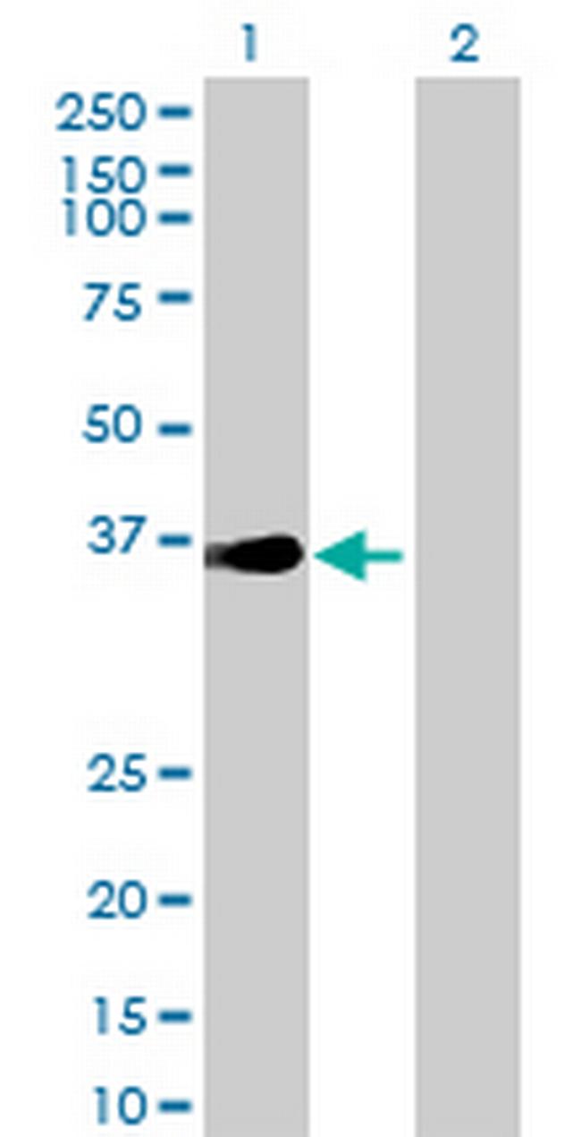 ZIK1 Antibody in Western Blot (WB)