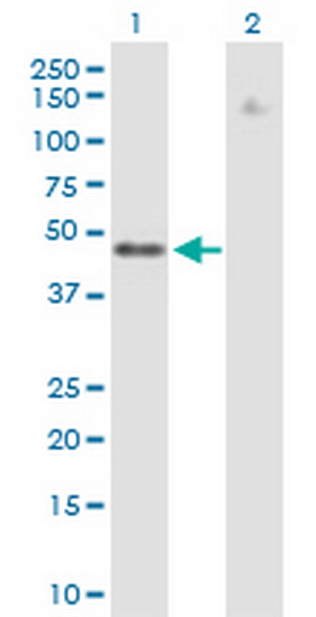 ZNF776 Antibody in Western Blot (WB)