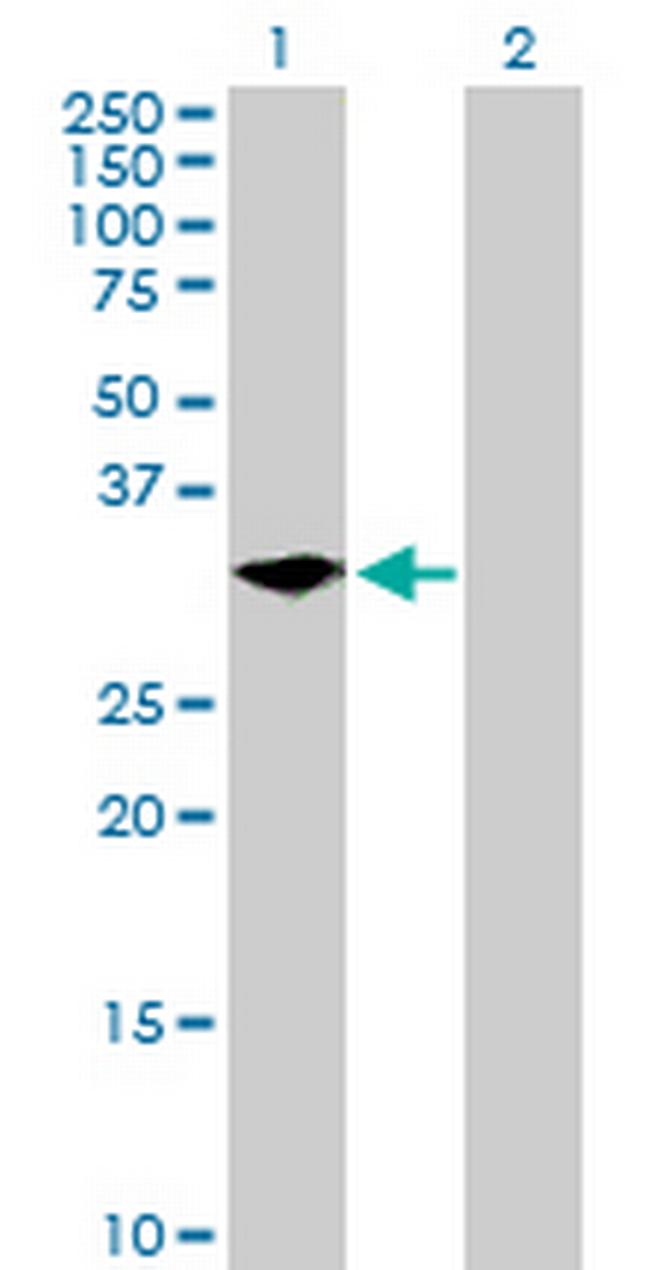 LYPD5 Antibody in Western Blot (WB)