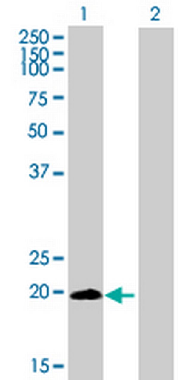 LYPD5 Antibody in Western Blot (WB)