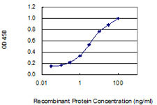 WDR62 Antibody in ELISA (ELISA)