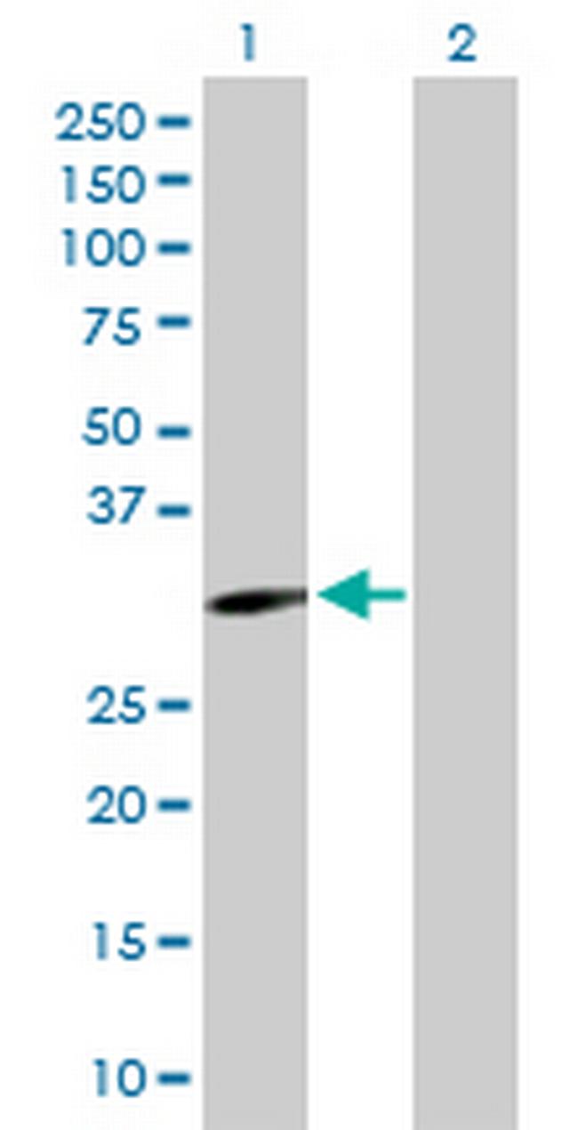 EPHA10 Antibody in Western Blot (WB)
