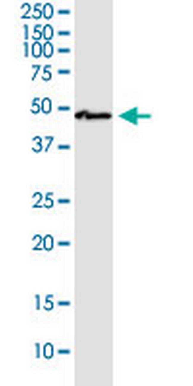 SLC9A9 Antibody in Western Blot (WB)