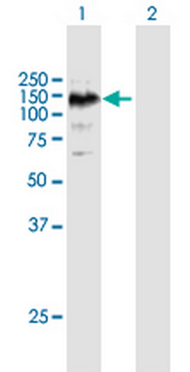 EPHA6 Antibody in Western Blot (WB)