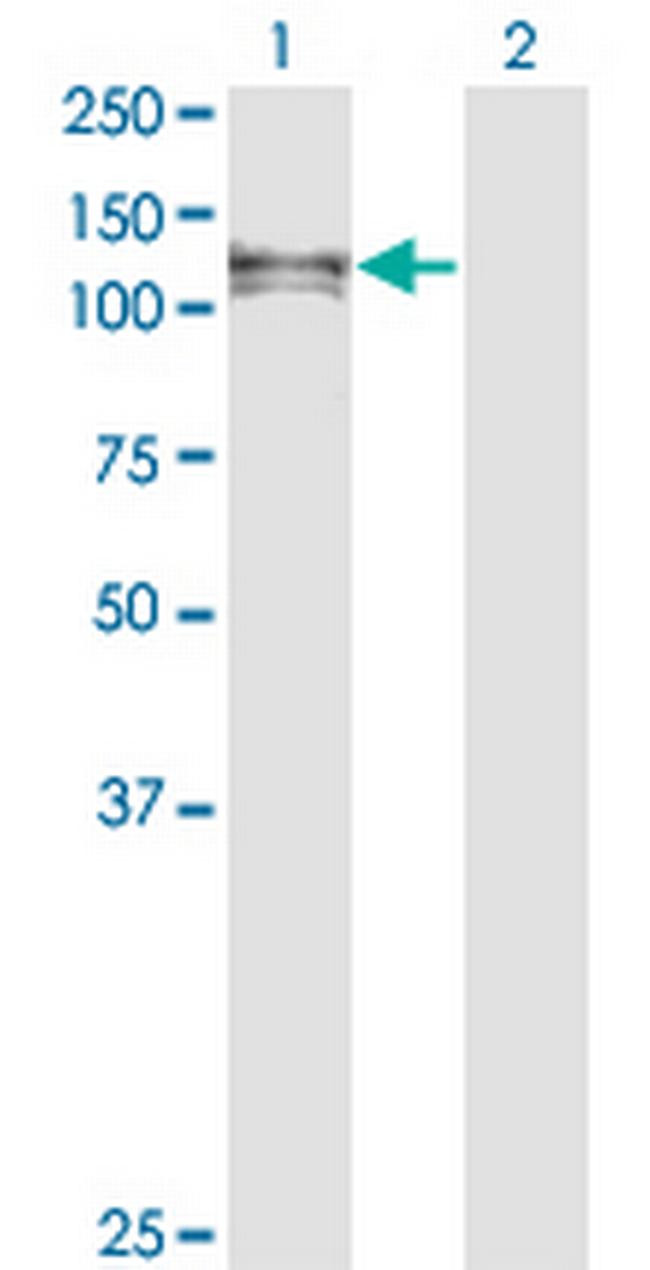 EPHA6 Antibody in Western Blot (WB)