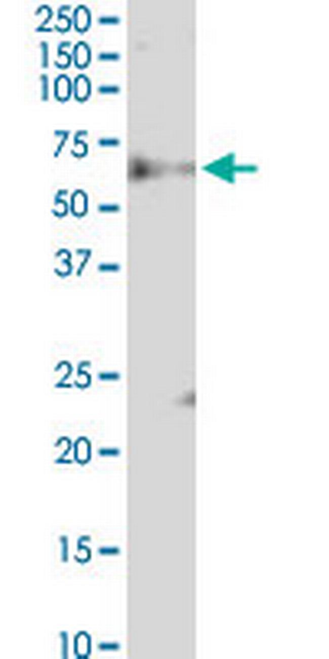 FBXW12 Antibody in Western Blot (WB)