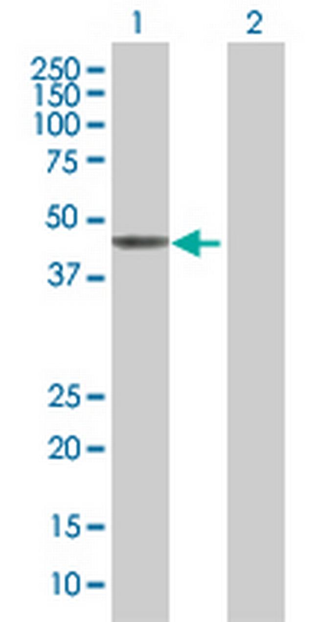 ZNF621 Antibody in Western Blot (WB)
