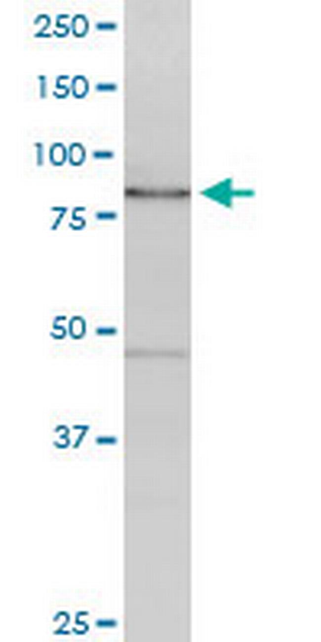 CAGE1 Antibody in Western Blot (WB)