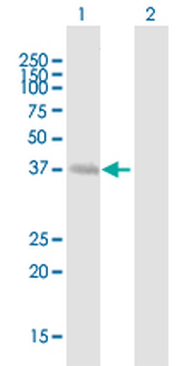ZNF707 Antibody in Western Blot (WB)