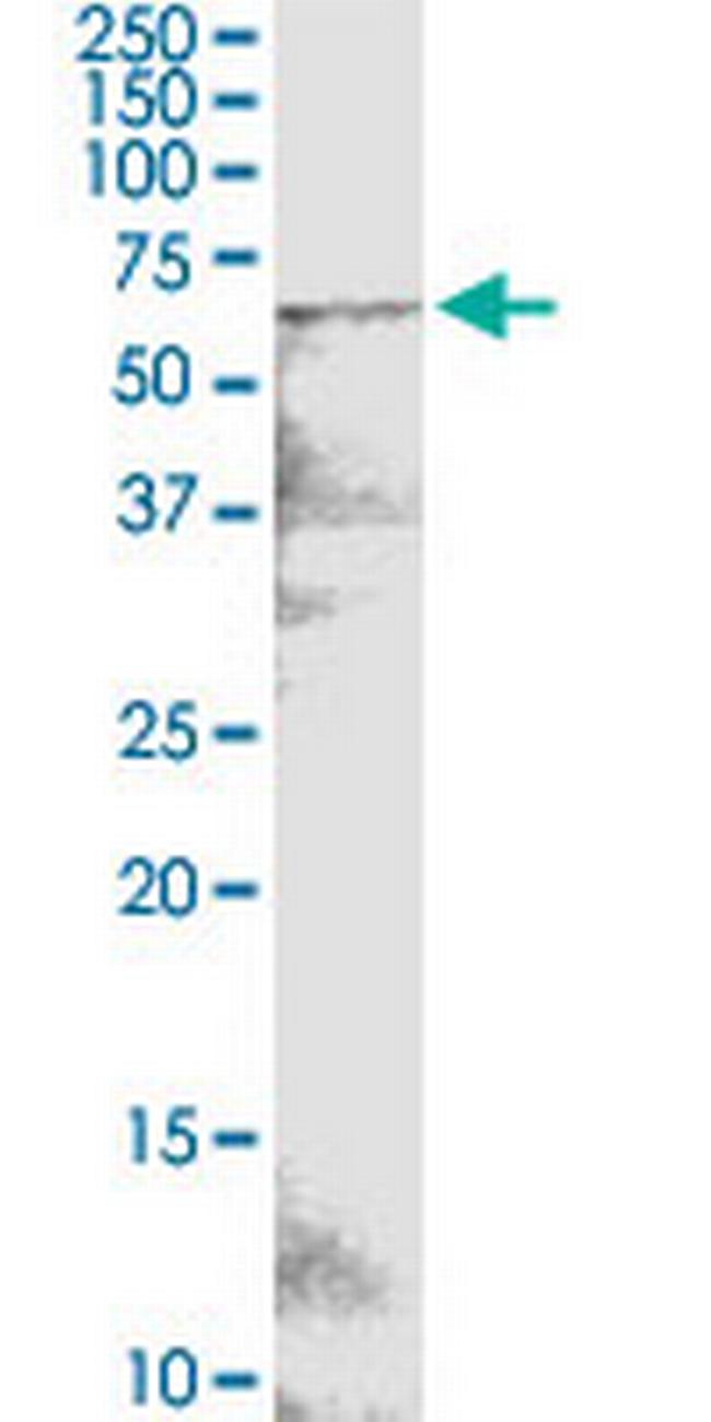POTED Antibody in Western Blot (WB)