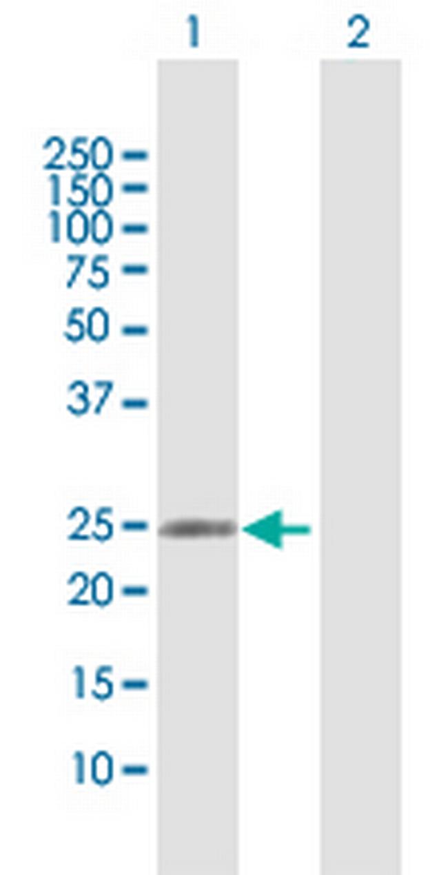 RAB37 Antibody in Western Blot (WB)