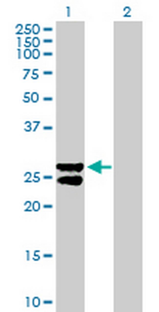 MMAB Antibody in Western Blot (WB)