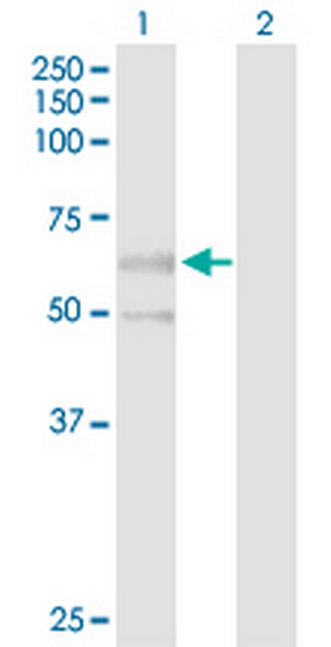 PPM1J Antibody in Western Blot (WB)